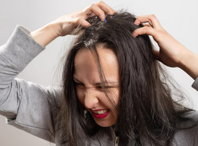Anti dandruff shampoo benefits and what your scalp says about your health